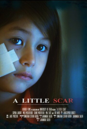 A Little Scar трейлер (2014)