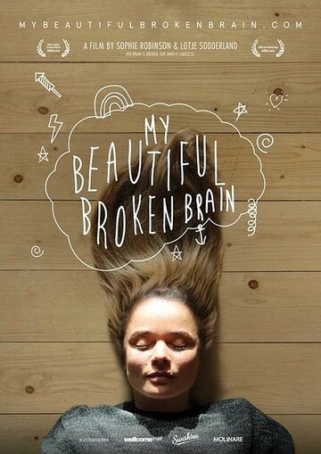 My Beautiful Broken Brain трейлер (2014)